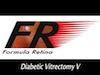 Diabetic Vitrectomy V