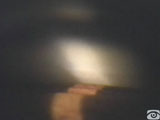 Corneal Wedge in Non-pigmentented Angle