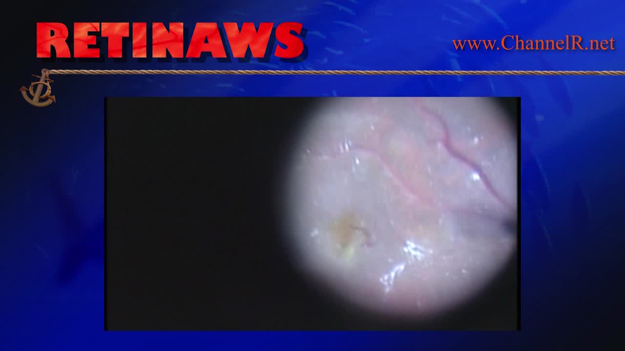 Thumbnail for mrwev