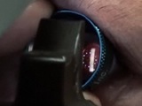 The Light Adjustable IOL