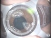 IEK: Preoperative Planning