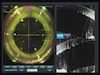 Treating Astigmatism with Femtosecond Lasers