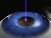 Personalized Vision Correction