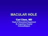 Macular Hole