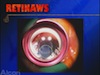 23G Cannula Insertion - Preventing Leaks