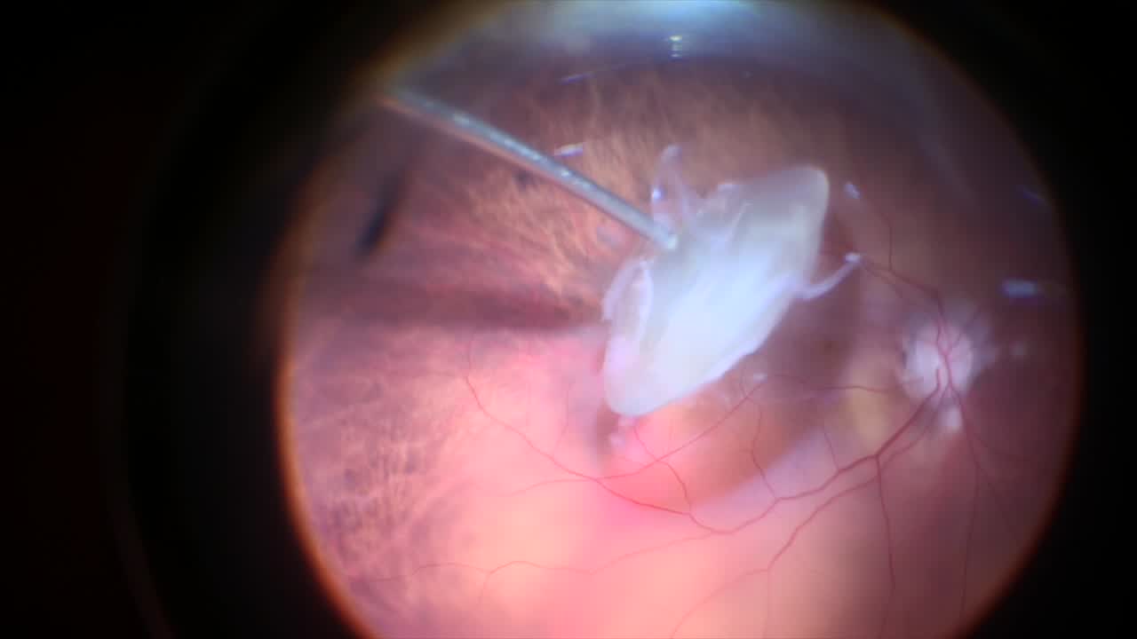 Hypervit Probe