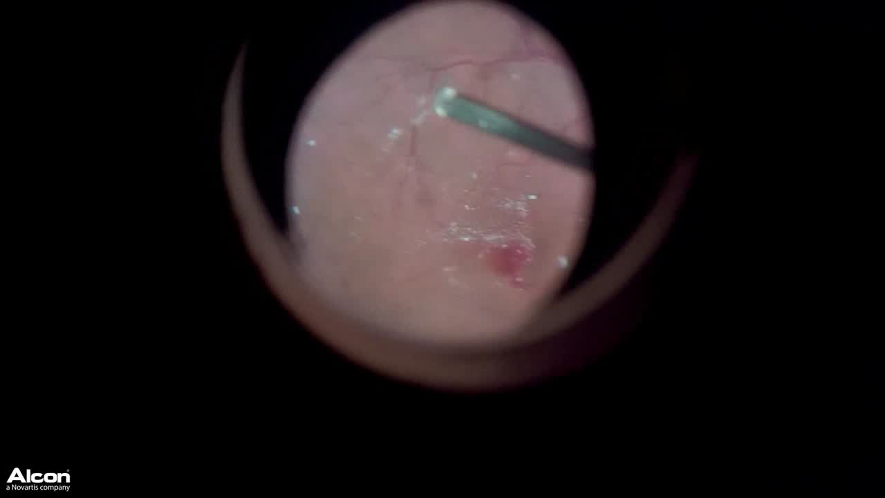 Unexpected Complication