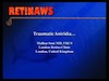 Traumatic Aniridia