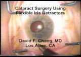Cataract Surgery Using Flexible Iris Retractors