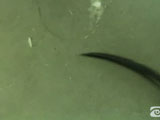 Scleral Fixation