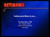 Subluxated Black Lens