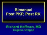 Bimanual Phaco in a Post-PKP and Post-RK Eye