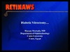 Diabetic Vitrectomy