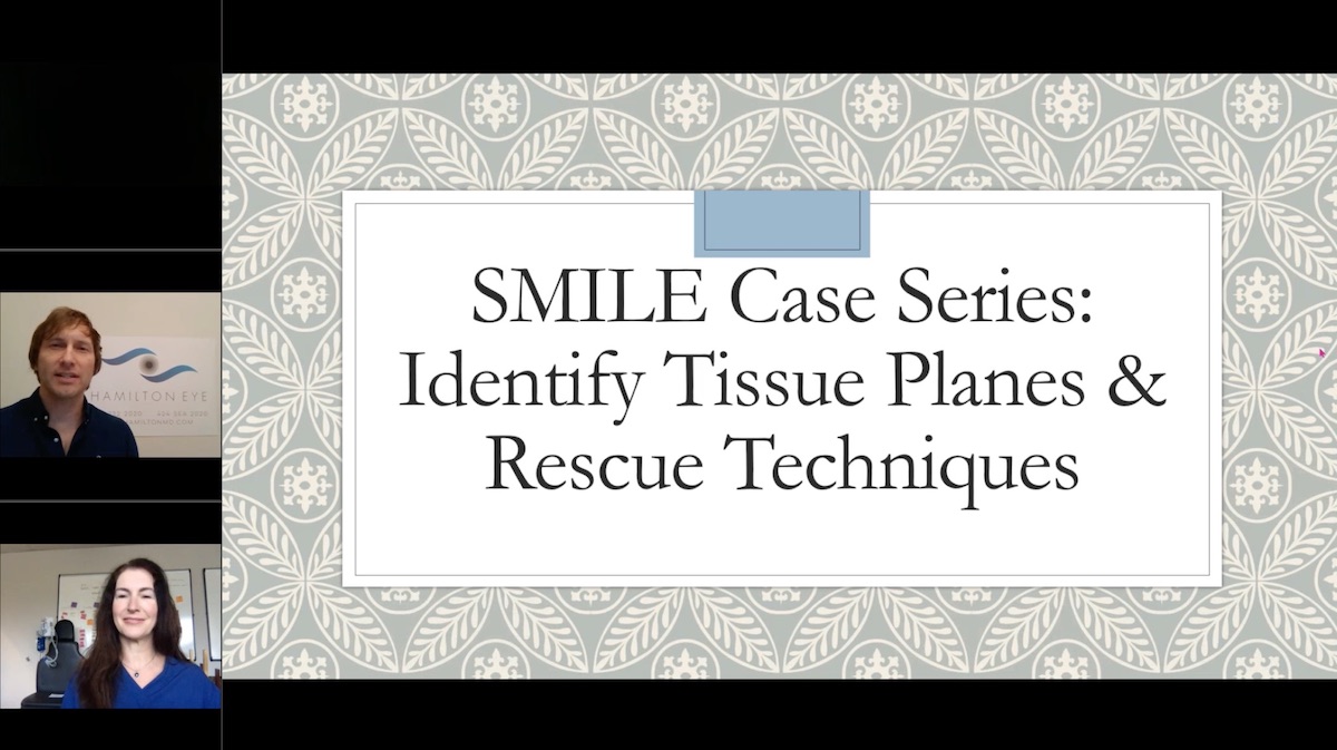 SMILE Case Series: Identify Tissue Planes & Rescue Techniques
