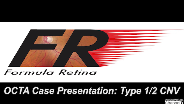Case Presentation- Type 1-2 CNV