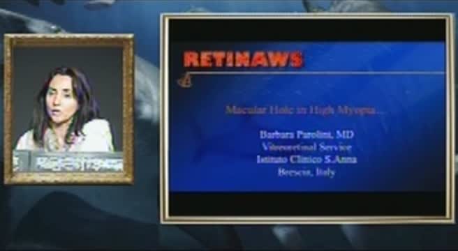 Macular Hole in High Myopia