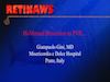 Bimanual Dissection in PVR
