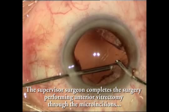 Learning B-MICS: Tips, Tricks and Complications for Surgeons in Training