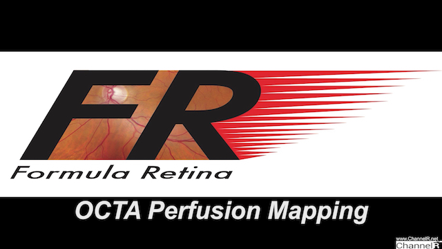 OCTA Perfusion Mapping