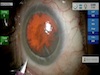 Richard Mackool: Centurion Case 3