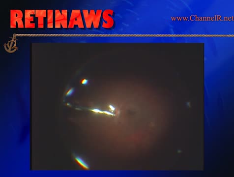 Thumbnail for ohovu