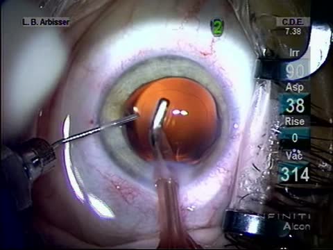 Hidden Nuclear Chunk