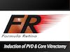 Induction of PVD & Core Vitrectomy