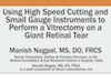 MIVS to Perform a Vitrectomy on a Giant Retinal Tear