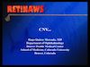 CNV