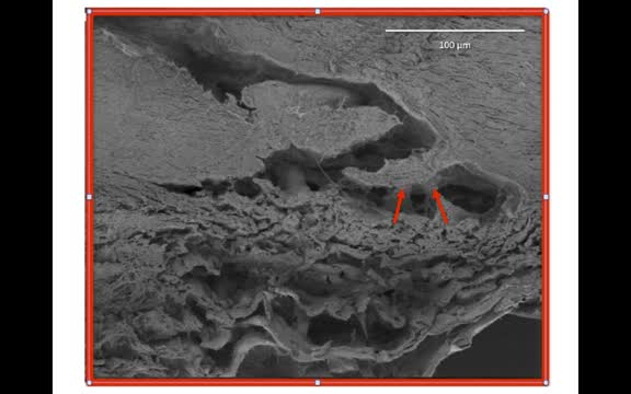 Collector Channels Open and Close: Important Considerations in MIGS Development