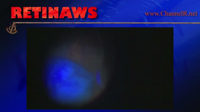 Thumbnail for onimq