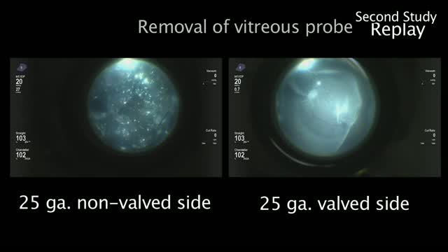 Comparison of Valved and Non Valved Trocar Cannulas During Surgical Technique with Perfluoro-N-Octane