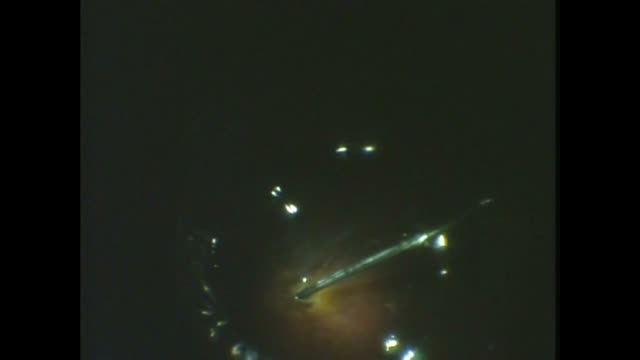 Total Retinal Detachment with Posterior Pole Fibrosis