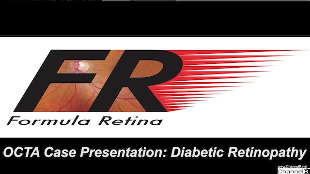 Case Presentation - Diabetic Retinopathy