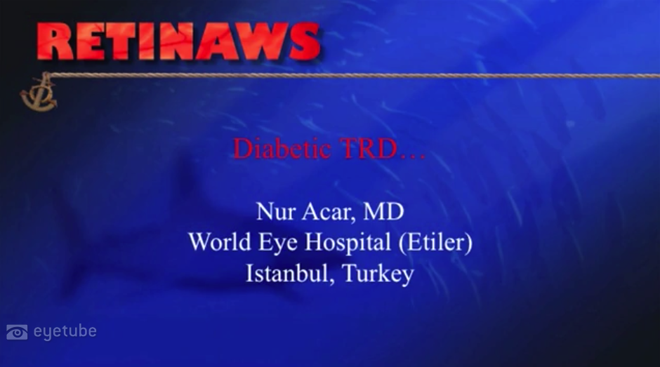 Diabetic TRD