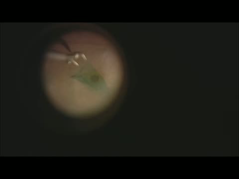 Macular Hole Repair