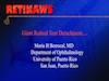 Giant Retinal Tear Detachment 