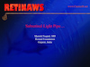 Subretinal Light Pipe