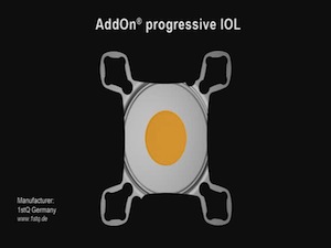 AddOn Progressive IOL