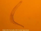 Cornea Worms