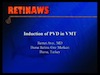 Induction of PVD in VMT