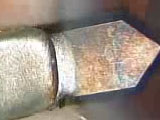 Malyugin Ring and Trypan Blue in Small Pupil