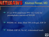Flat AC Following PPV+EL+GAS