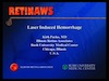 Laser Induced Hemorrhage