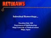 Subretinal Hemorrhage