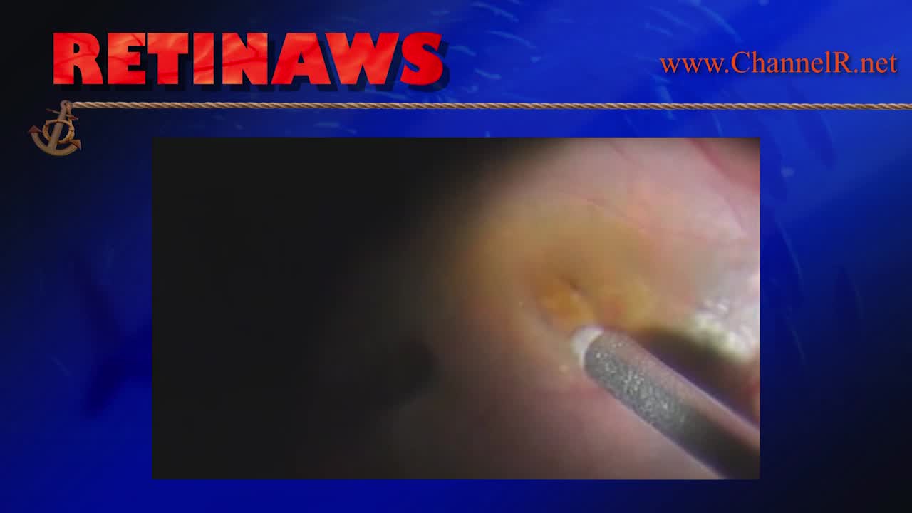 Thumbnail for pvgeg