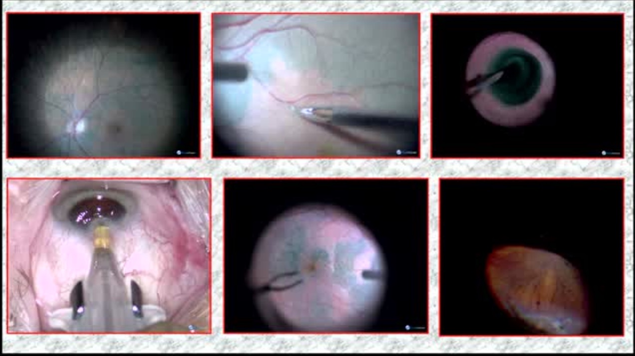 Why Digital Microscopy Will Rule the Operating Rooms of Tomorrow