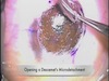 Scissors Deep Anterior Lamellar Keratoplasty
