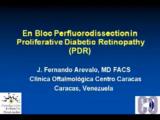 Proliferative Diabetic Retinopathy