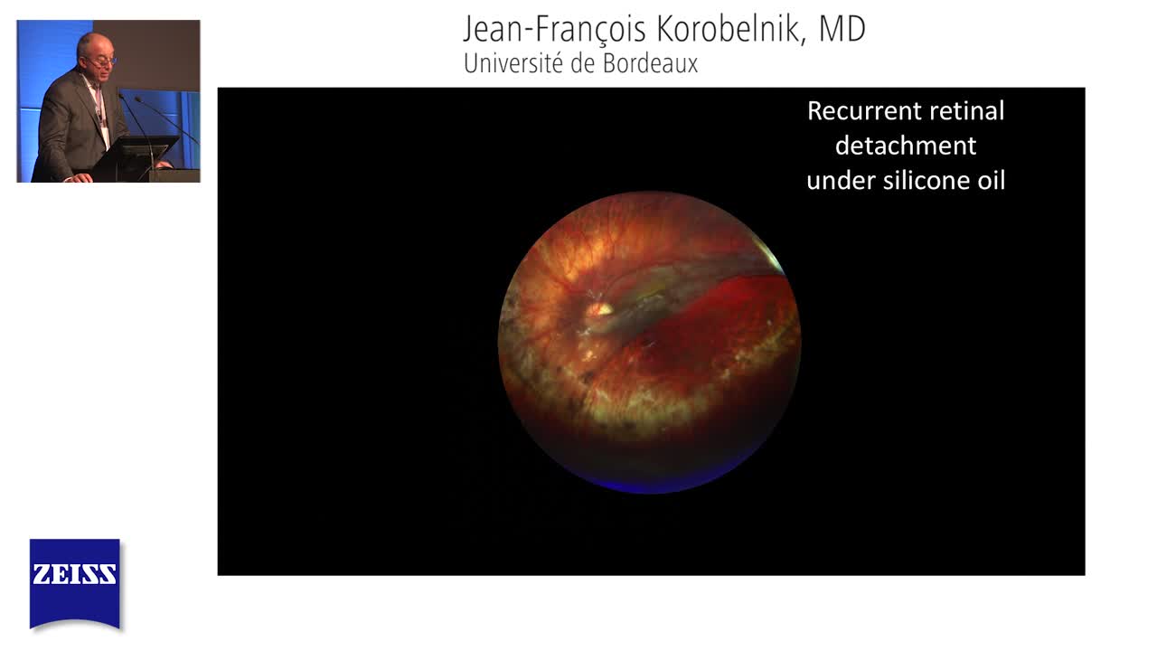 Case Review with Prof. Korobelnik: ZEISS CLARUS 500